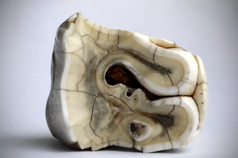 Российские учёные создали искусственную зубную эмаль тверже натуральной