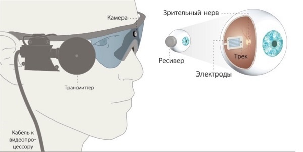 В России слепоглухому пациенту впервые установили бионический глаз