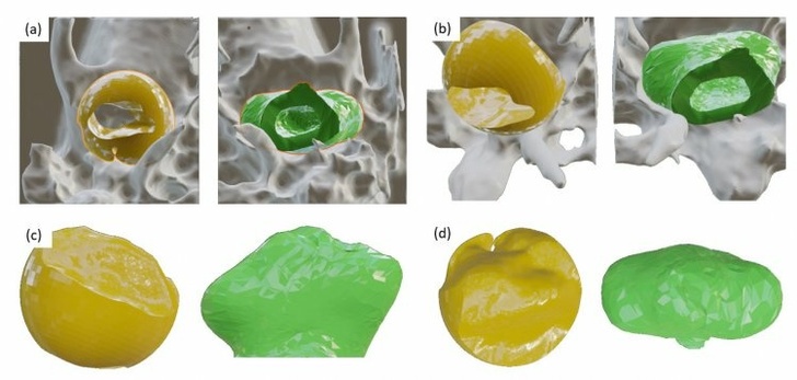 Рисунок 3. Визуализированные области височной кости отмечены серым цветом, отрицательный объем височно-нижнечелюстного сустава отмечен желтым (распознано вручную) и зеленым (сгенерировано алгоритмом). Виды: (а) аксиальный, снизу; (b) аксиальный, под наклоном; (c) сбоку; (d) сверху. Изображение: Кристина Беликова и др./Scientific Reports