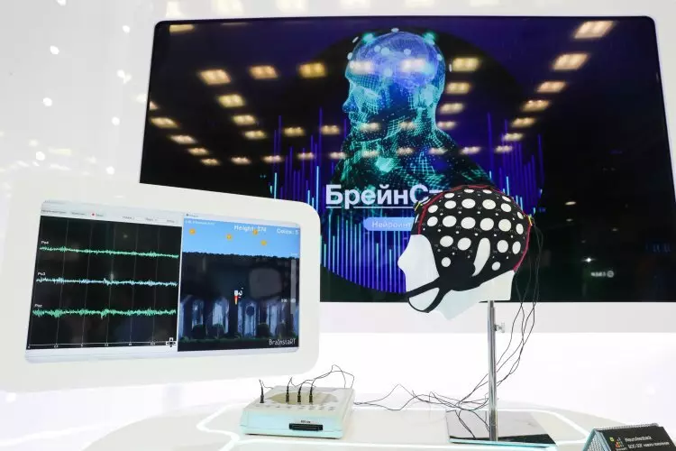 Фото #6 для поста «Главные достижения российской медицины последних лет»