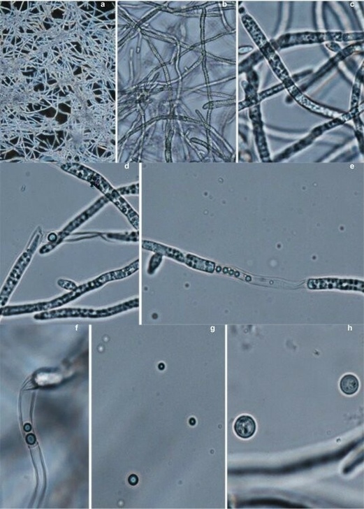 Микрофотографии гриба Gibberella zeae. Источник: Kollerov V. and Donova M. / AMB Express, 2022