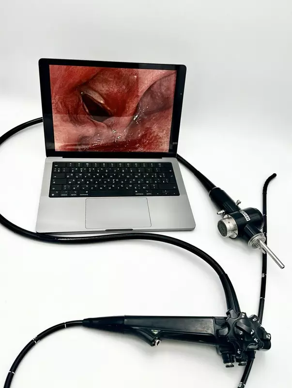 4 для новости «НевскиеТехнологии: В России модернизировали эндоскопы до решение от Невских Технологий»