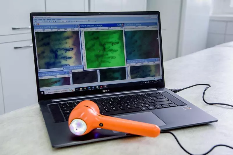 Картинка №2 для публикации «НИОКРы: Перспективные разработки московских врачей»