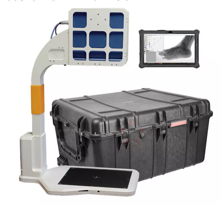 Резидент ОЭЗ Технополис Москва разработал компактный рентгеновский аппарат