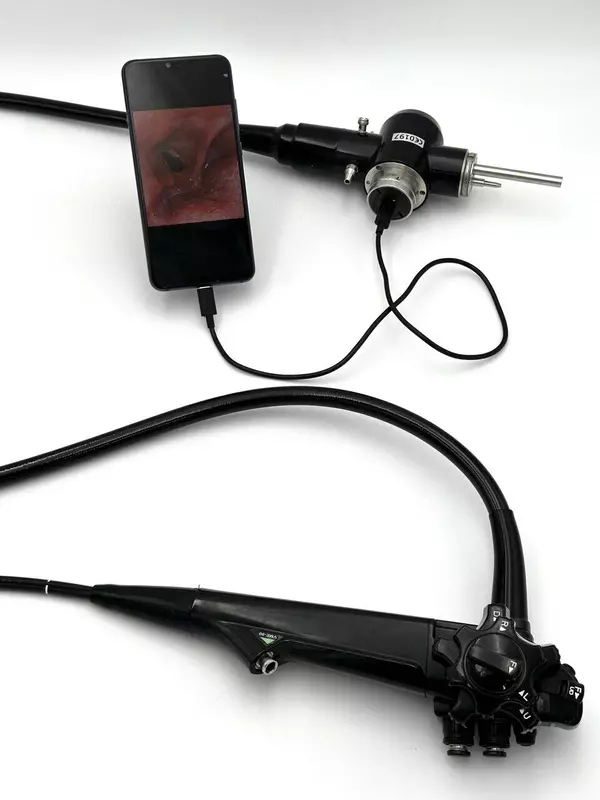 Картинка #2 для поста «НИОКРы: В России модернизировали эндоскопы до решение от Невских Технологий»