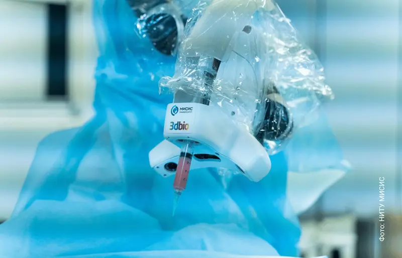 Фото #3 для публикации «медицина: Российские врачи провели первую в мире операцию с биопечатью на пациенте»