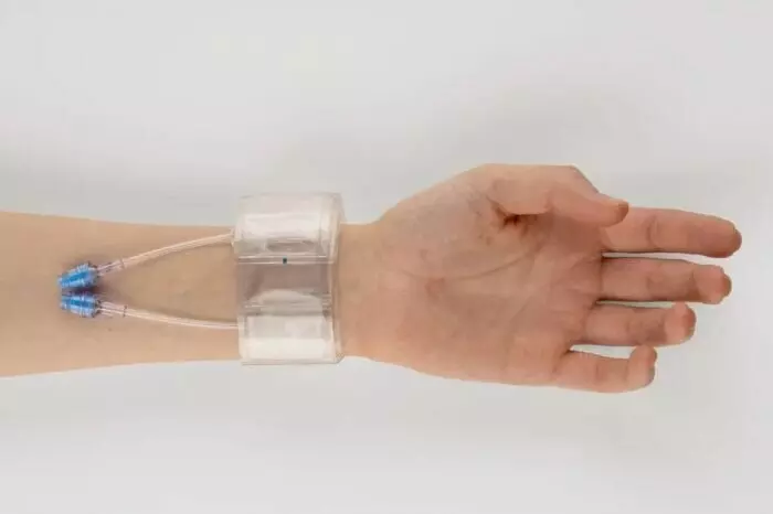 Московские ученые разработали браслет для остановки кровотечений и систему газоочистки ТЭС