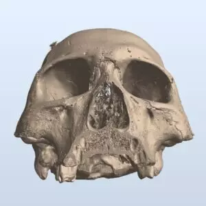 Иллюстрация #1 для «Информационные технологии: Замена импортного ПО для томографии»