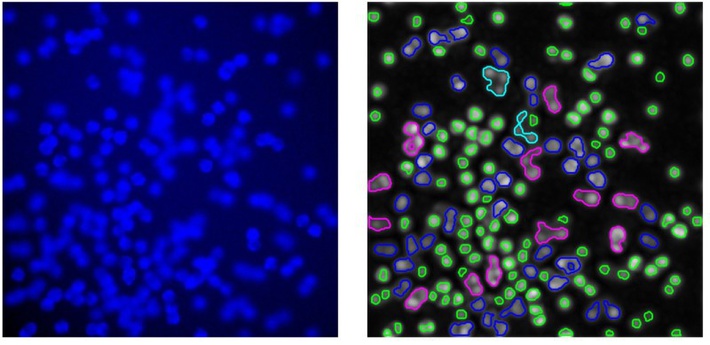 Пример работы метода (справа) на сложном для анализа флюоресцентном изображении (слева): зеленые регионы соответствуют (по мнению метода) отдельным клеткам, синие – группам из двух клеток, фиолетовые из трех, голубые – из пяти.