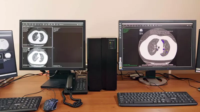 Изображение #3 для поста «Эльбрус-16С: В России используется первый отечественный комплекс на 16 ядерном Эльбрусе для врачей рентгенологов»