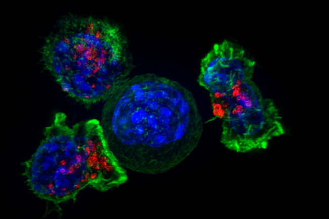 Иммунные клетки человека борются с «оборотнями» (в центре), но сил хватает не всегда. Фото: NIH Image Gallery/flickr