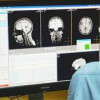 Технология интерактивной стимуляции мозга помогает восстановиться после инсульта