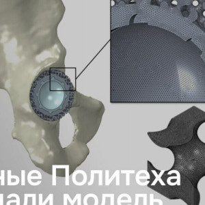 Симбиоз металла и&nbsp;живой ткани: инновация питерского Политеха